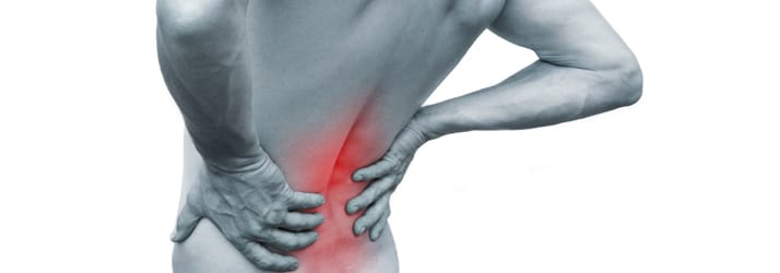 Back Pain in Mount Maunganui